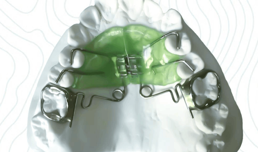 Orthodontic Appliance Production
