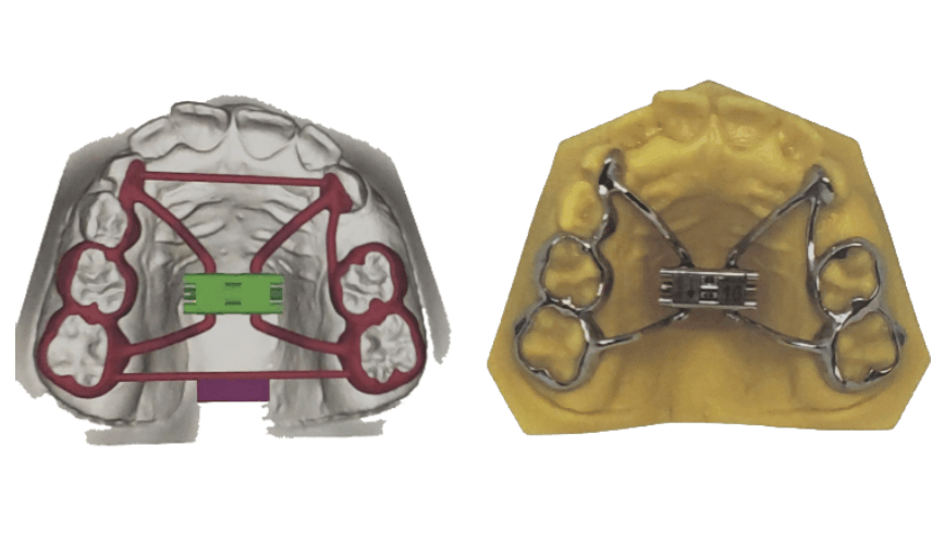 Digital Orthodontic Lab Services